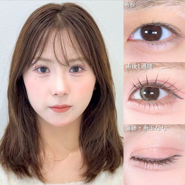 No.17258の症例写真