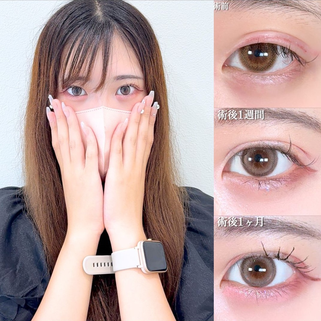 No.17205の症例写真 No.17205の症例写真