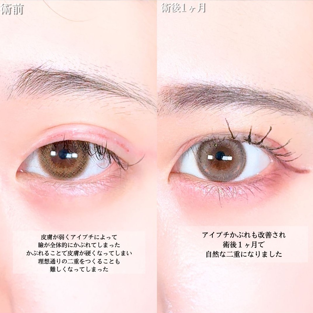 No.17205の症例写真1