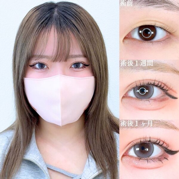No.17264の症例写真
