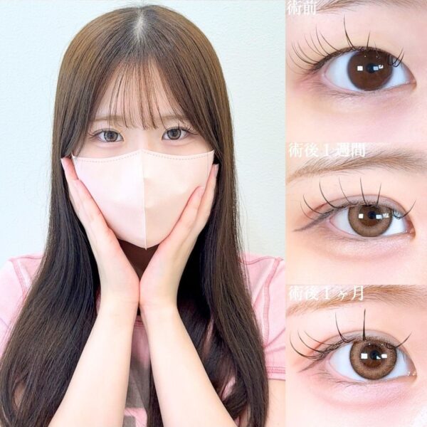 No.17324の症例写真
