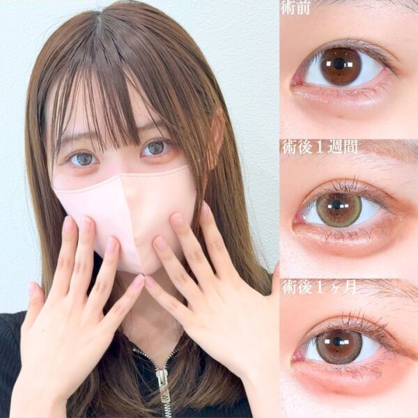No.17199の症例写真