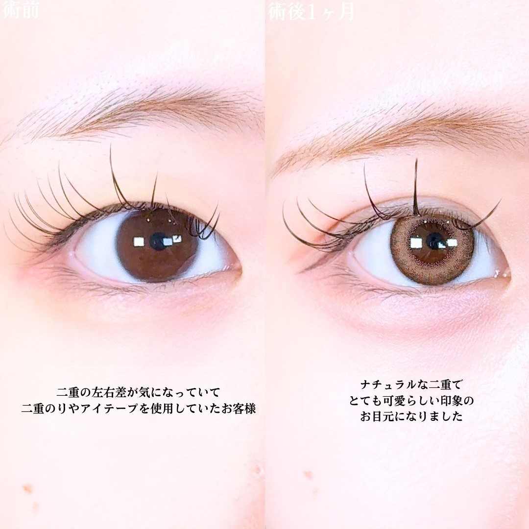No.17324の症例写真1