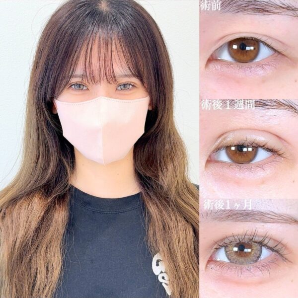 No.17417の症例写真