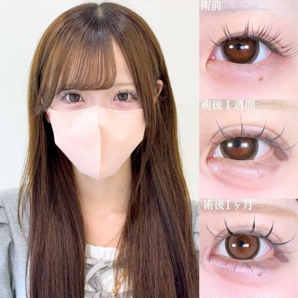 No.17538の症例写真