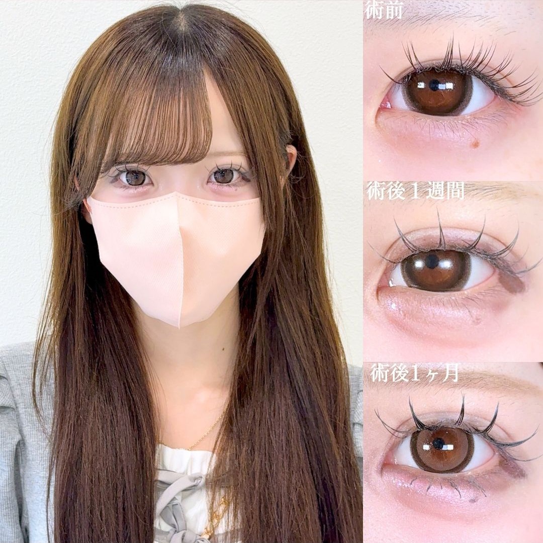No.17538の症例写真