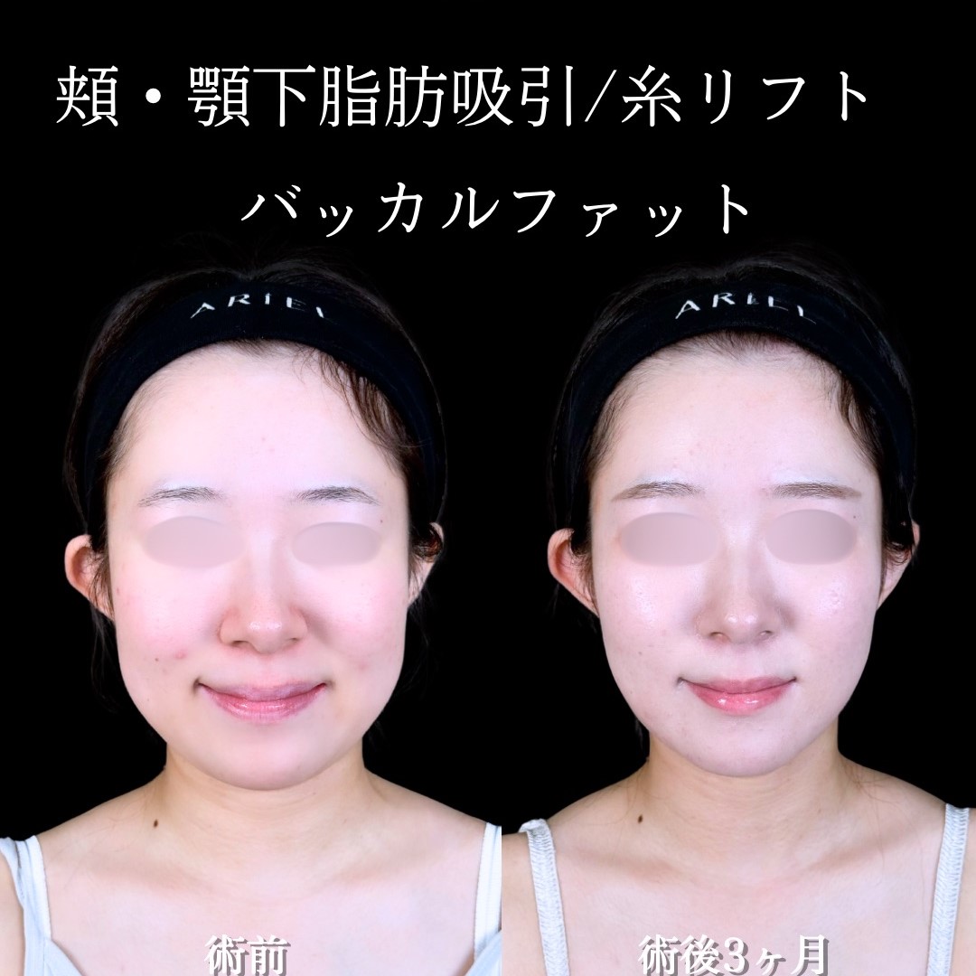 No.17552の症例写真2