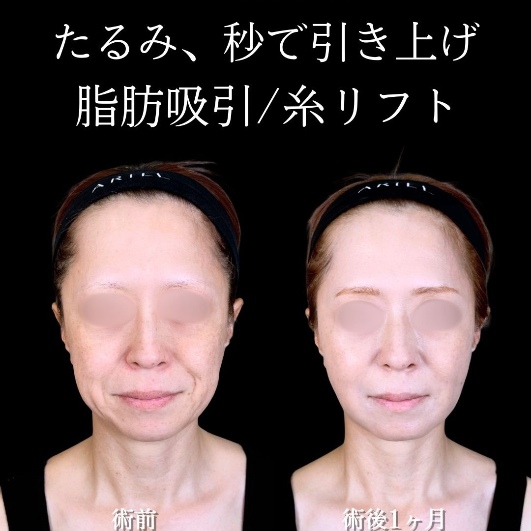 No.17215の症例写真 No.17215の症例写真