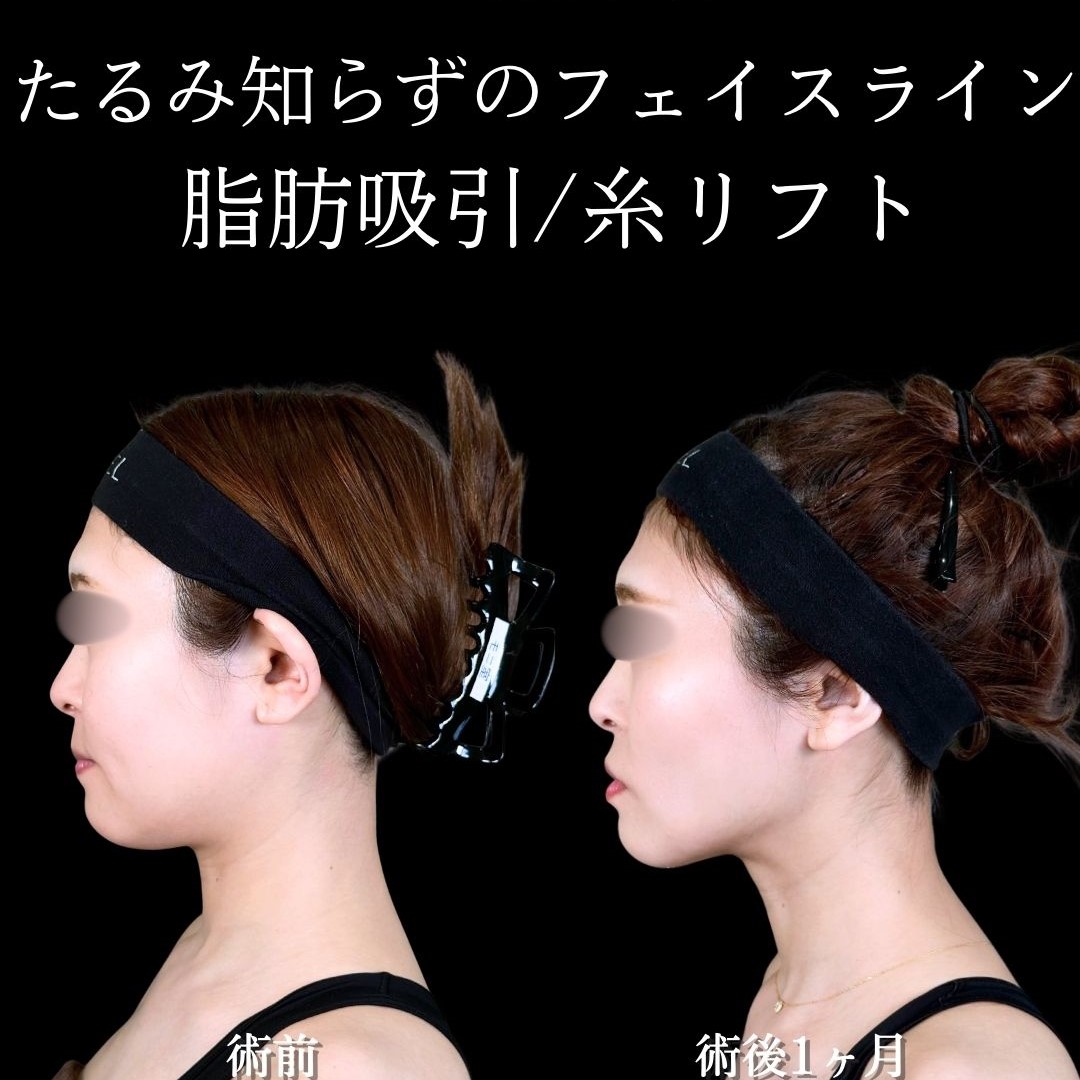 No.17277の症例写真 No.17277の症例写真