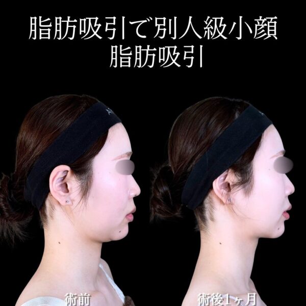 No.17338の症例写真