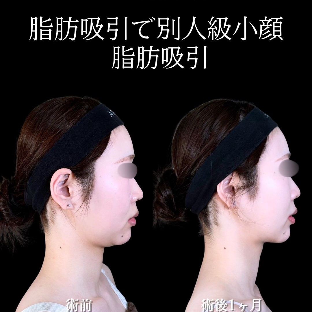 No.17338の症例写真