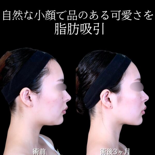 No.17365の症例写真