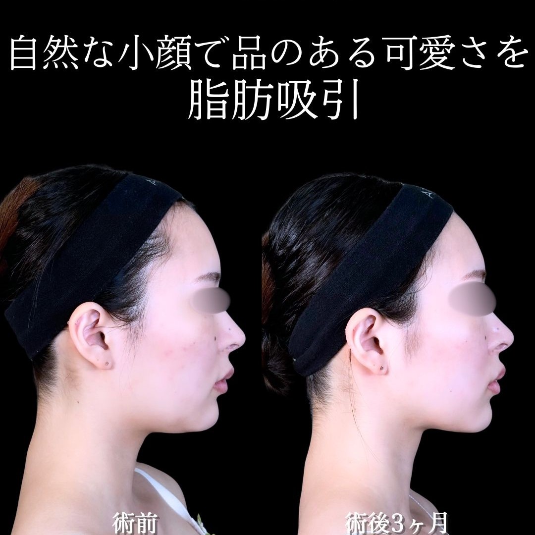 No.17365の症例写真