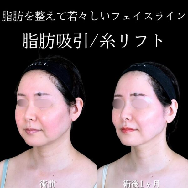 No.17497の症例写真