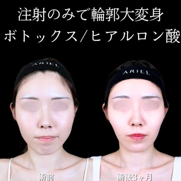No.17139の症例写真
