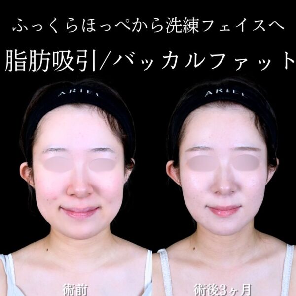 No.17552の症例写真