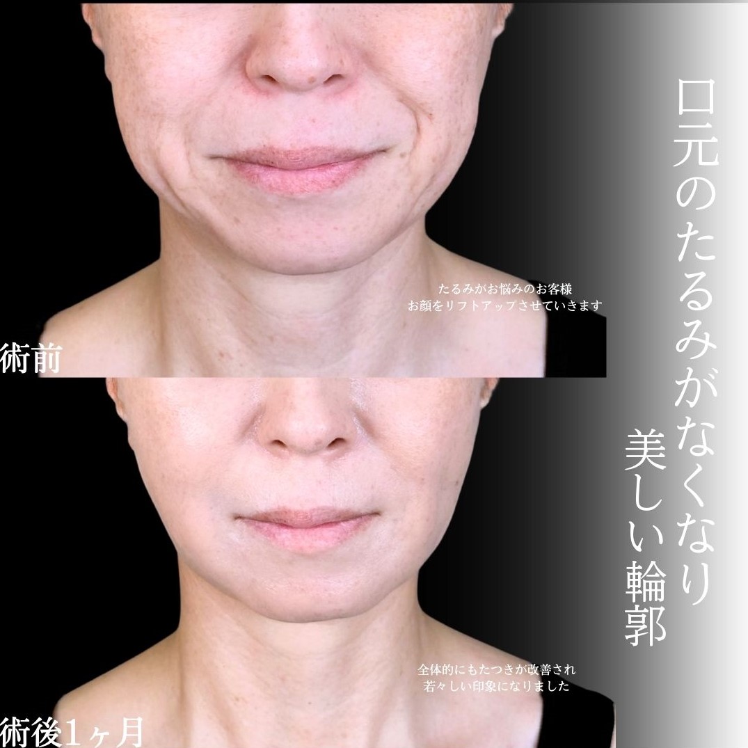 No.17215の症例写真1