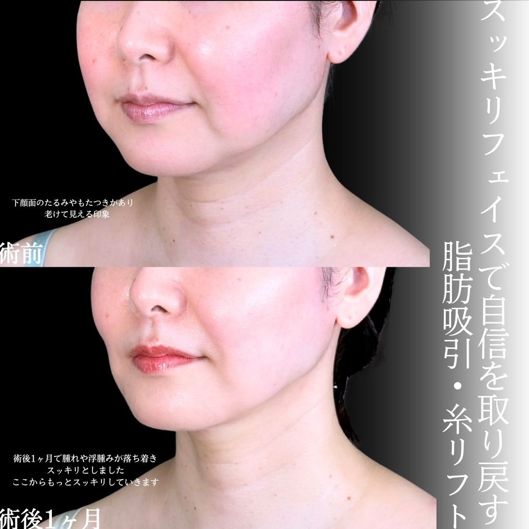No.17497の症例写真1