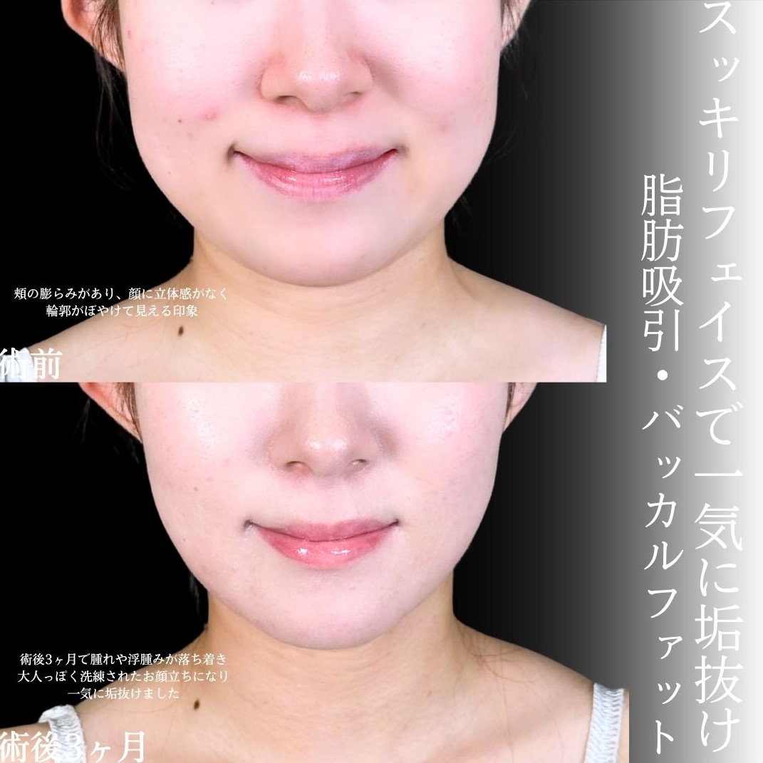 No.17552の症例写真1