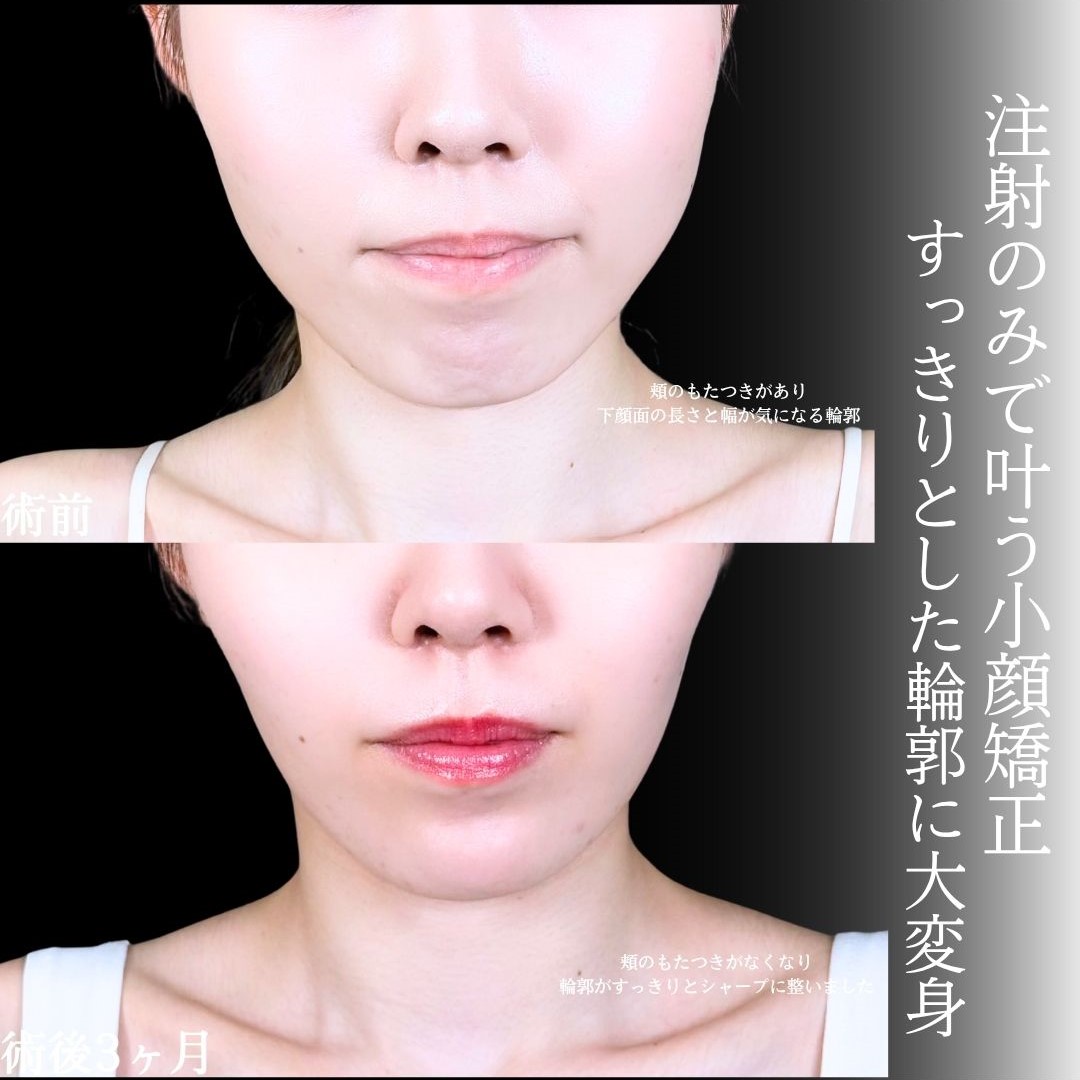 No.17139の症例写真1