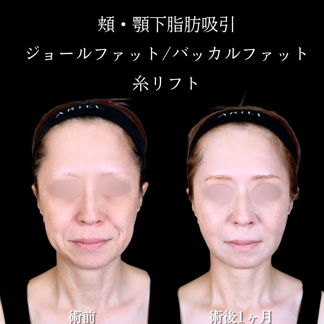 No.17215の症例写真2