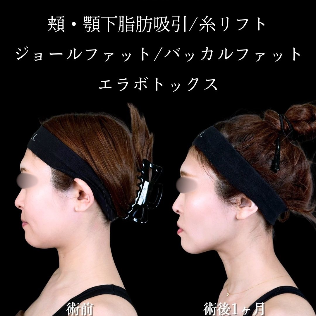 No.17277の症例写真2