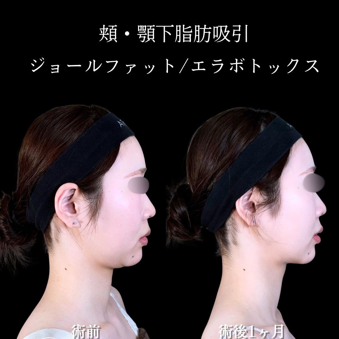 No.17338の症例写真2
