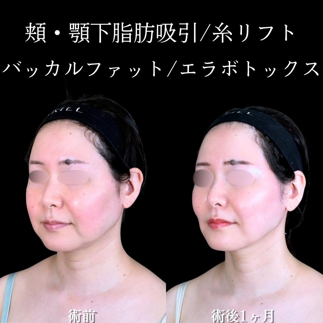 No.17497の症例写真2