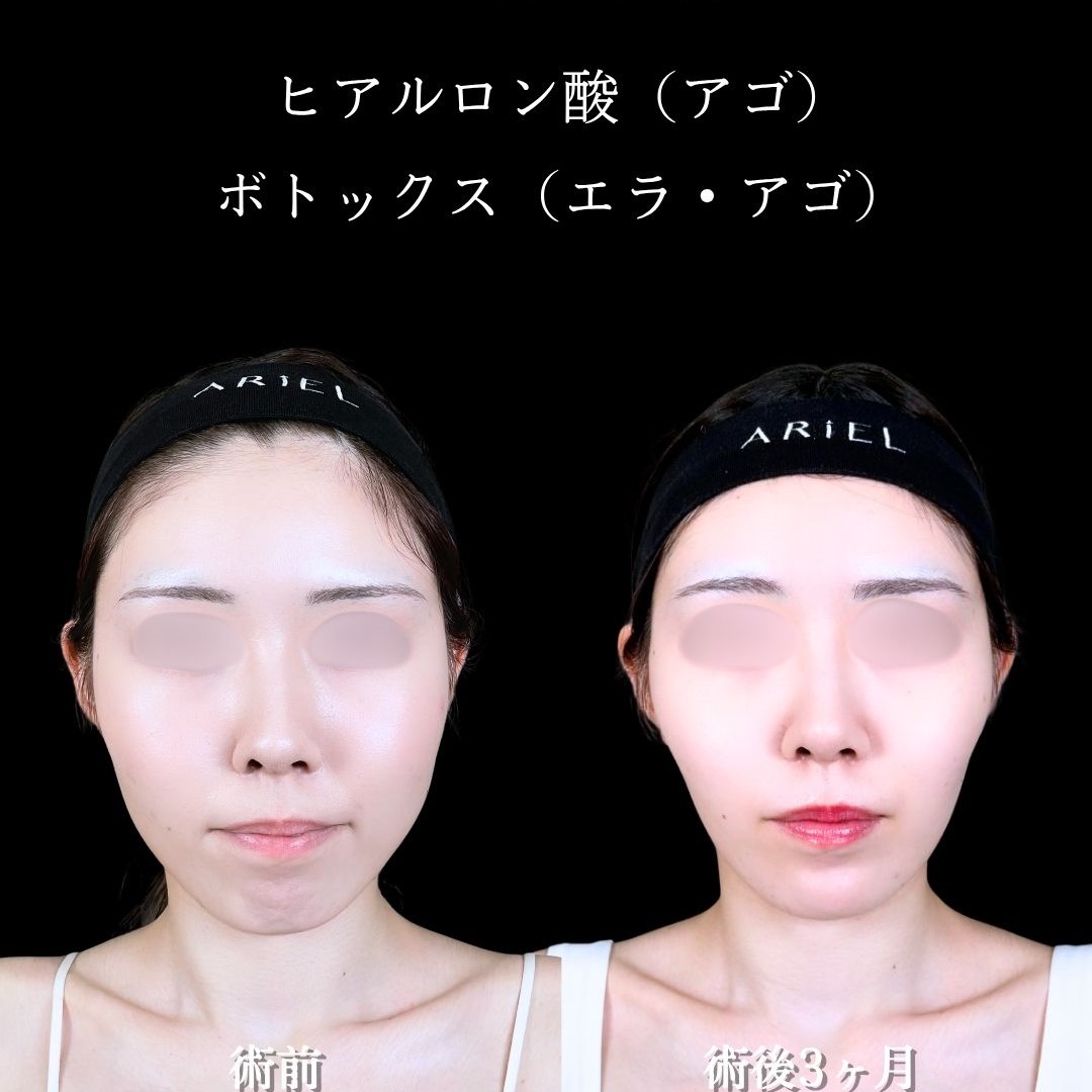 No.17139の症例写真2