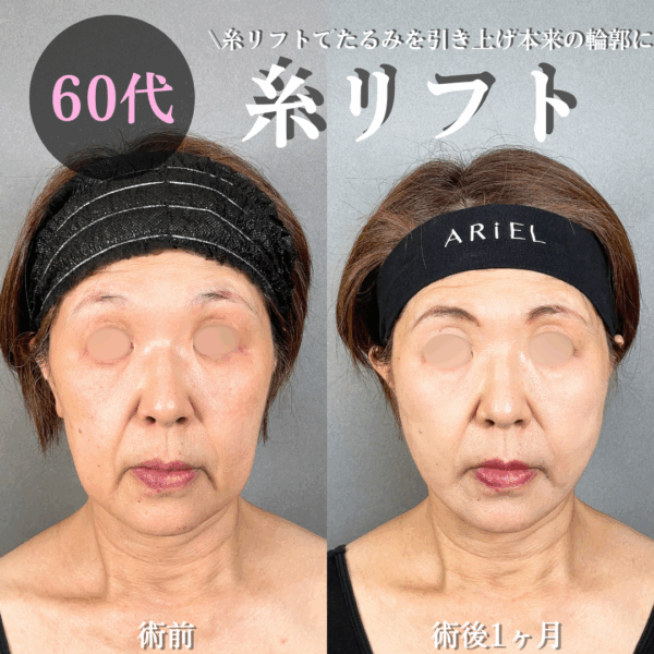 No.17211の症例写真