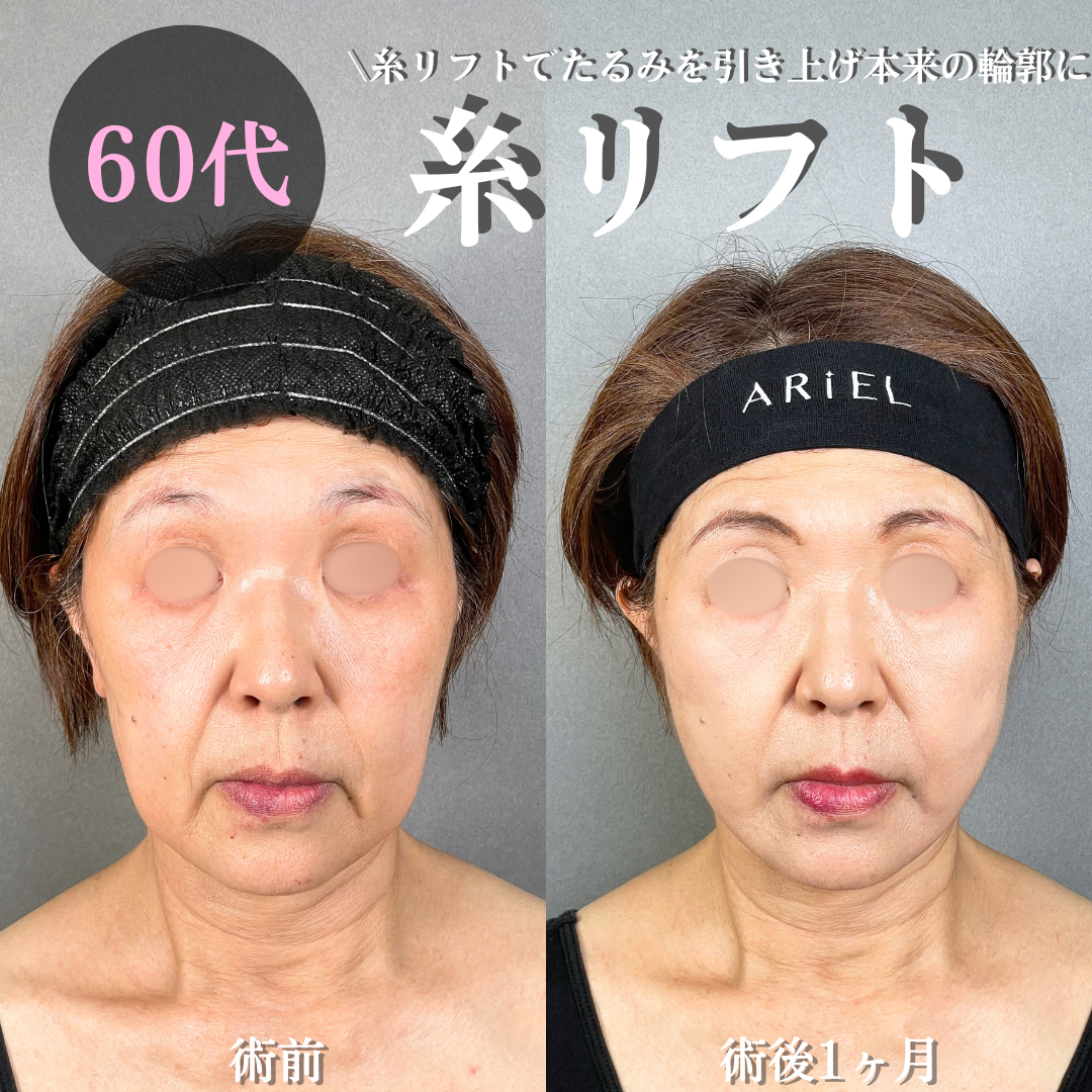 No.17211の症例写真 No.17211の症例写真