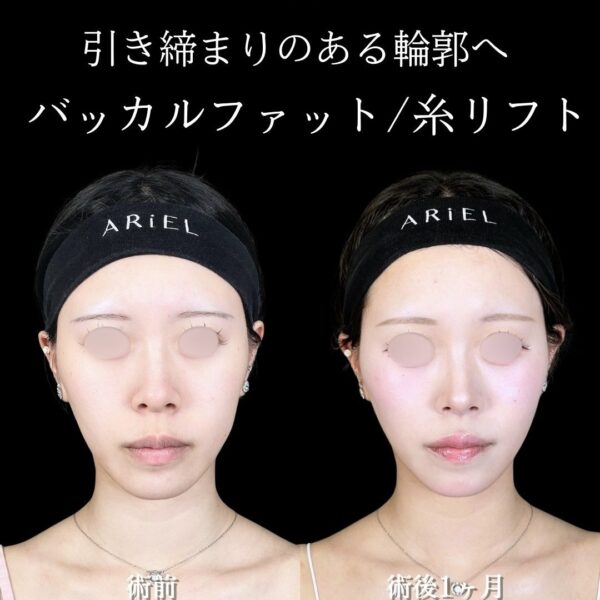 No.17387の症例写真