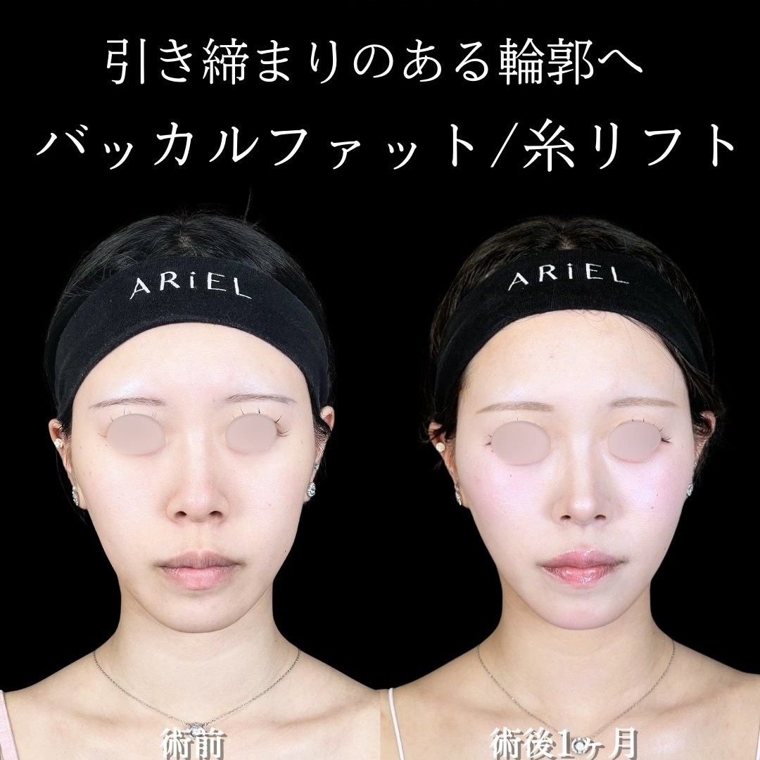 No.17387の症例写真 No.17387の症例写真