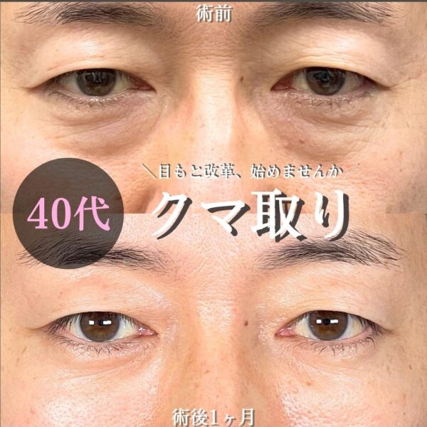 No.17270の症例写真