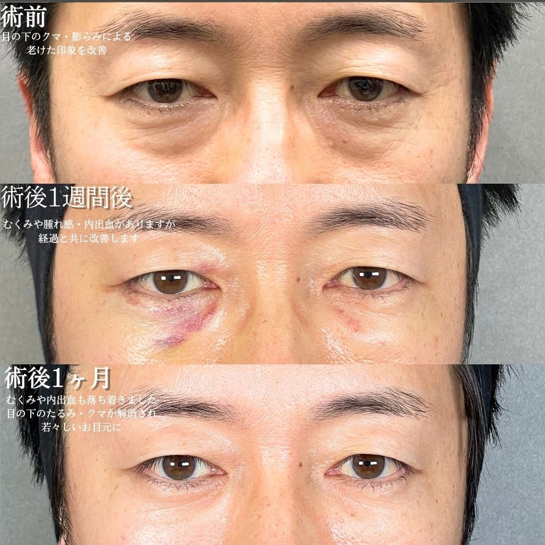 No.17270の症例写真1