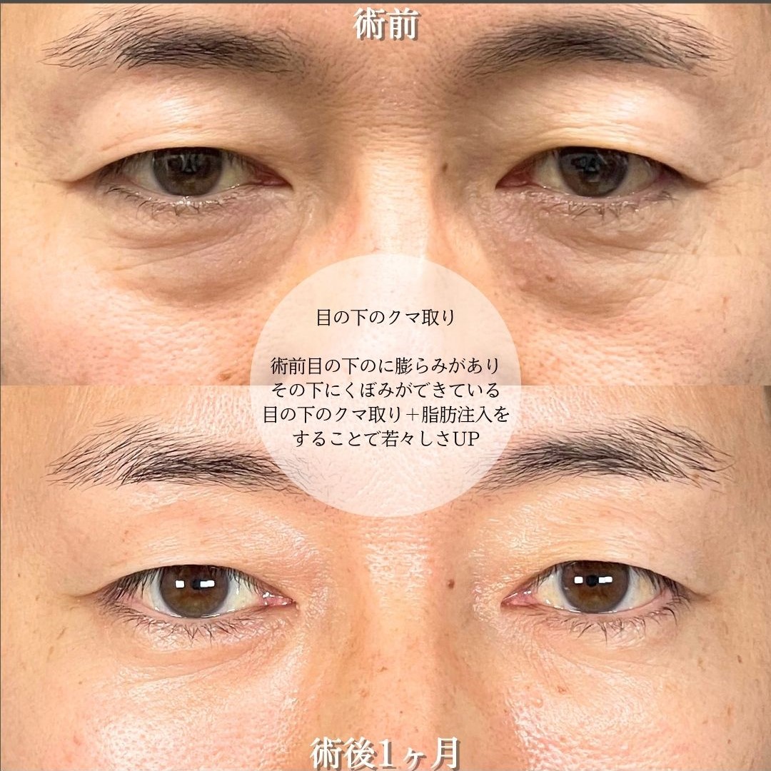 No.17270の症例写真2