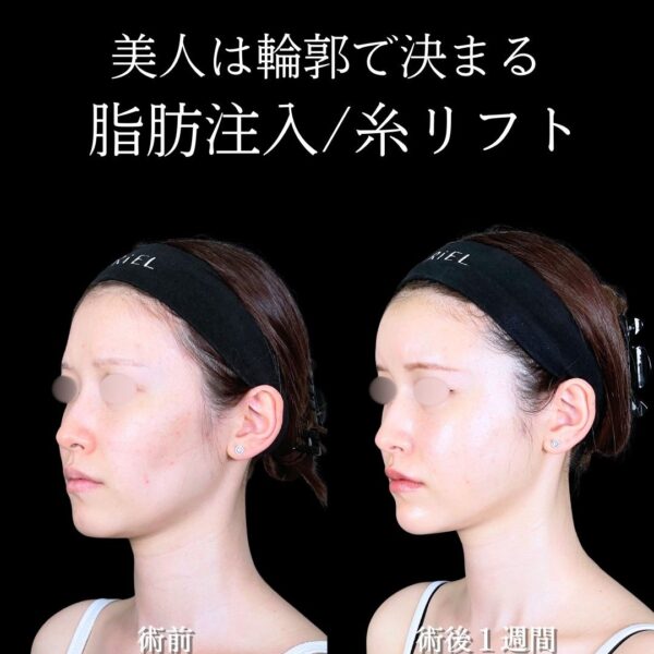 No.17766の症例写真