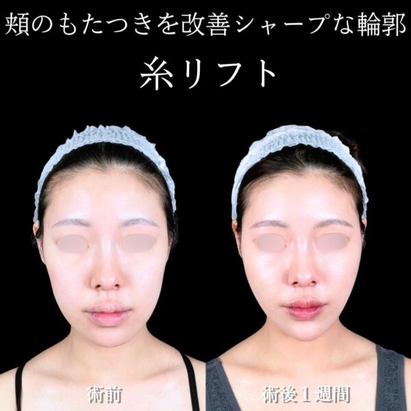 No.17781の症例写真