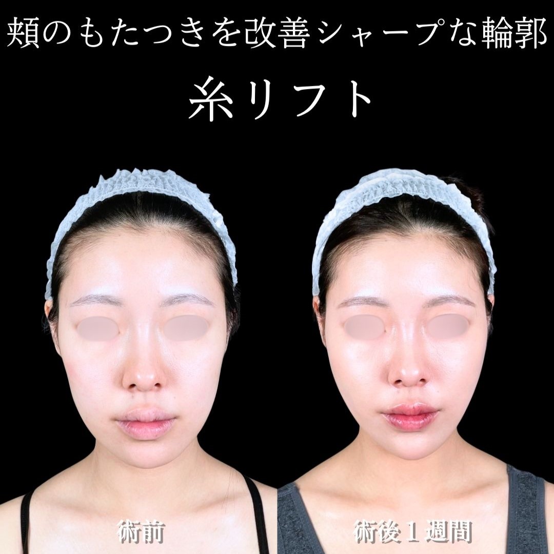 No.17781の症例写真