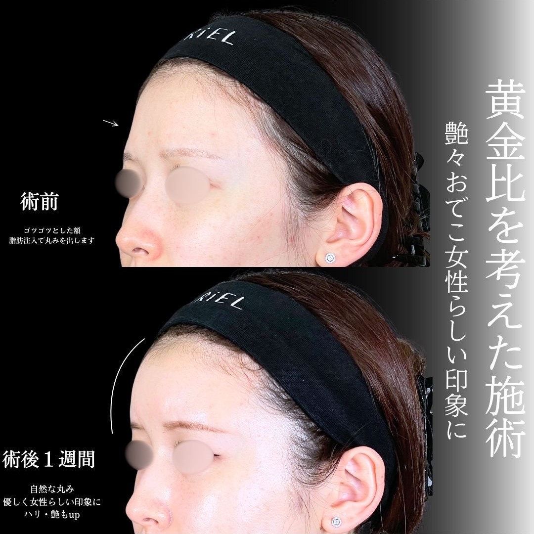 No.17766の症例写真1