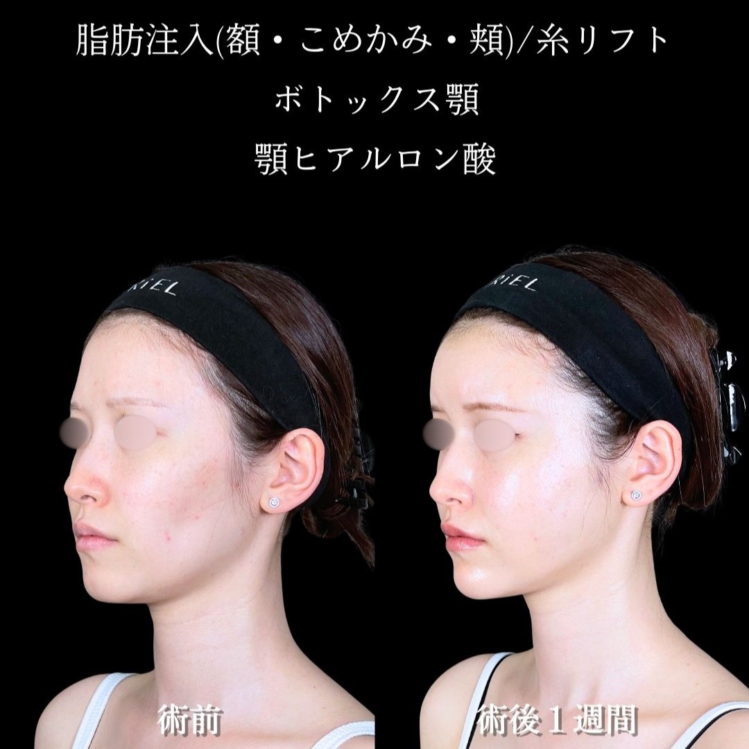 No.17766の症例写真2