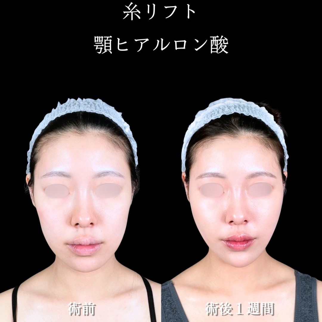 No.17781の症例写真2