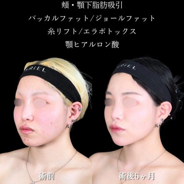 No.17591の症例写真