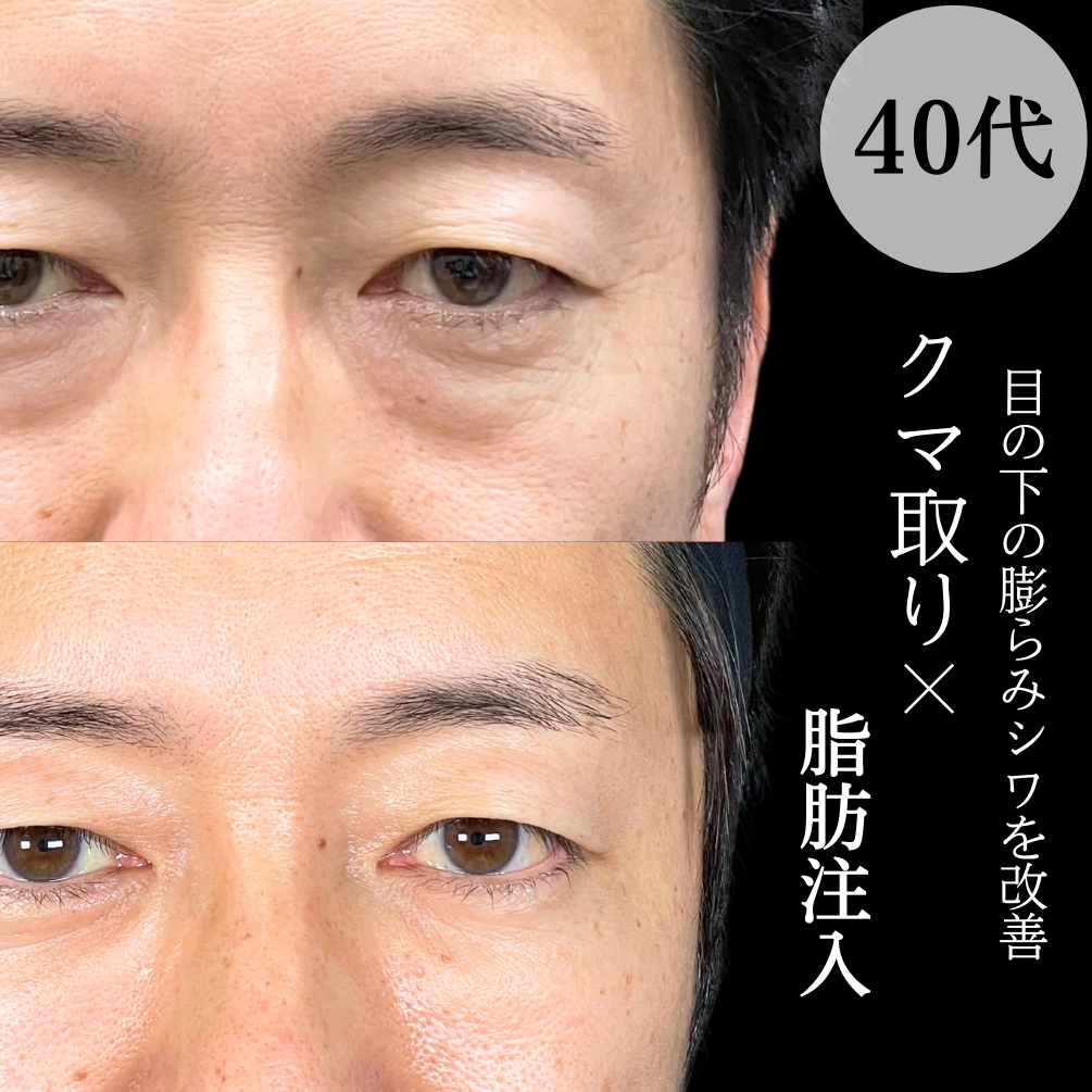 No.17723の症例写真