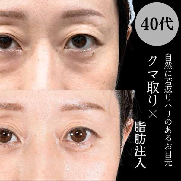 No.17788の症例写真