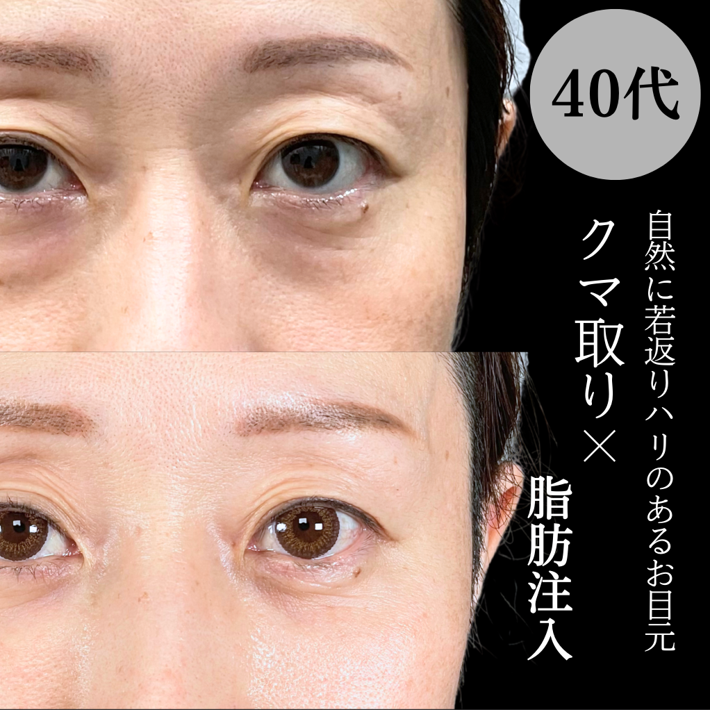 No.17788の症例写真