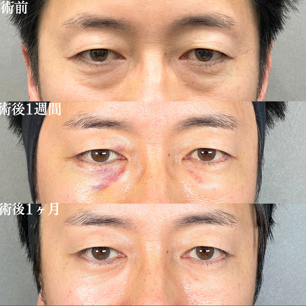 No.17723の症例写真1