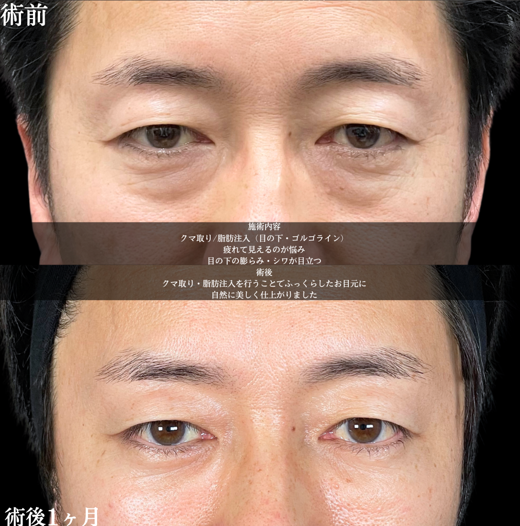 No.17723の症例写真2