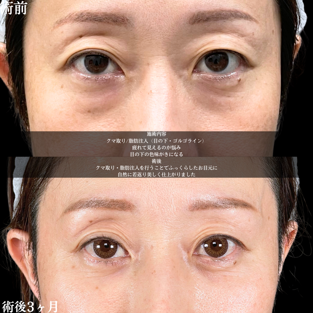 No.17788の症例写真1