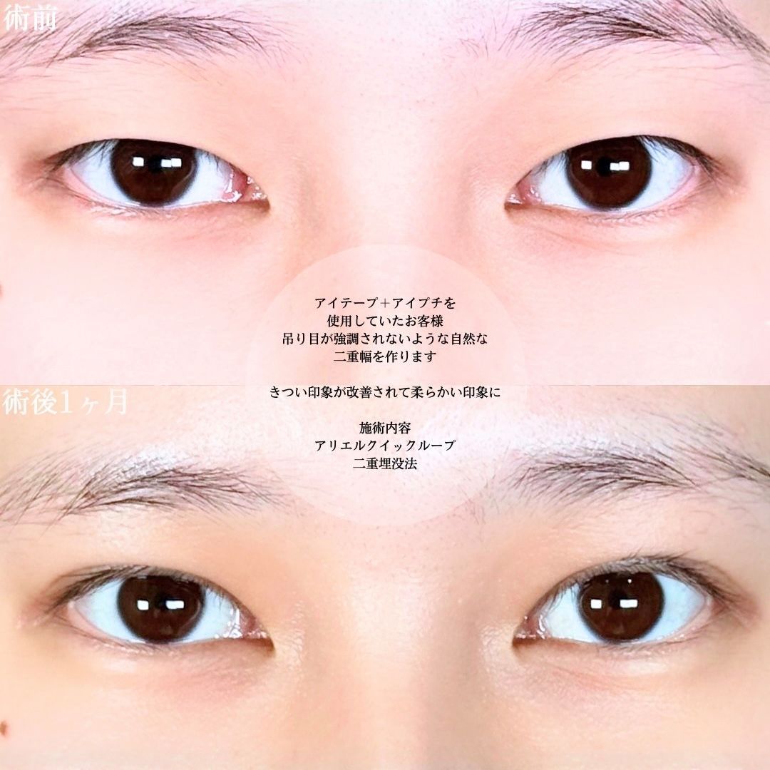 No.17610の症例写真1